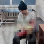 Attempt to avoid mobilisation: man hospitalised in Odesa</trp-post-container