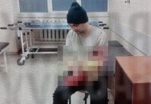 Attempt to avoid mobilisation: man hospitalised in Odesa A man in a medical facility after the incident
