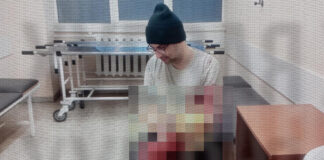 Attempt to avoid mobilisation: man hospitalised in Odesa A man in a medical facility after the incident