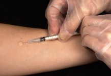 A health worker conducts a TB test in a laboratory