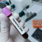 Poland takes contact person under surveillance due to hantavirus