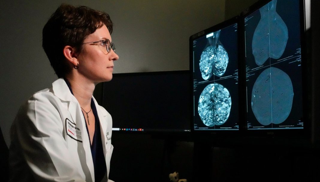 The result of a genomic test on a computer monitor for the treatment of breast cancer.
