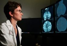 The result of a genomic test on a computer monitor for the treatment of breast cancer.