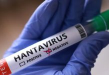 Suspected hantavirus on a remote island