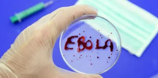 Ebola vaccine development is delayed