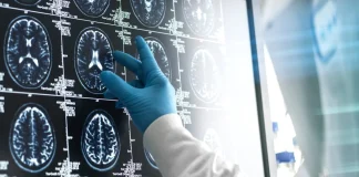 New drugs slow the progression of early-onset Alzheimer’s disease New drugs are already capable of slowing the progression of early-onset Alzheimer’s, and up to 45% cases of dementia could potentially be delayed