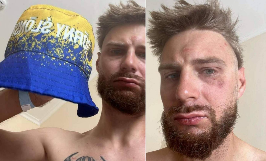 Polish cyclist beaten up over a blue-and-yellow hat