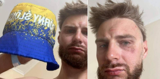 Polish cyclist beaten up over a blue-and-yellow hat