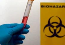 Франція повідомила про перший випадок вірусу Шамонда у людини Вірус Шамонда у людини