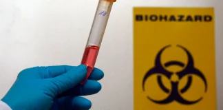 France has reported its first case of the Chamond virus in a human The Shamond virus in humans