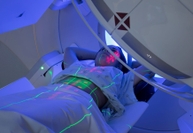 Cancer is «getting younger»: which diagnoses are becoming more common in people under 50 The patient is lying under a radiotherapy machine with laser markings on her body