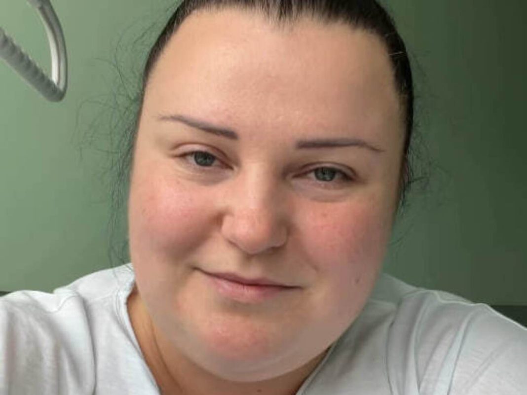 Alyona Alyona has had an operation: why she decided to go ahead with it and how she is feeling Alyona Alyona has had gastric bypass surgery: how is the singer feeling?