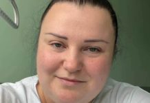 Alyona Alyona повідомила про операцію зі зменшення шлунка Alyona Alyona зменшила шлунок: як почувається співачка