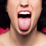 Bacteria on the tongue have been linked to the speed of thought